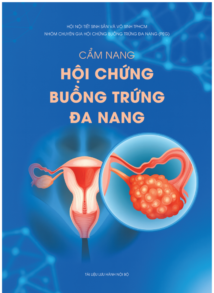 Cẩm nang Hội chứng buồng trứng đa nang